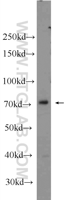 WB analysis of K-562 using 24480-1-AP