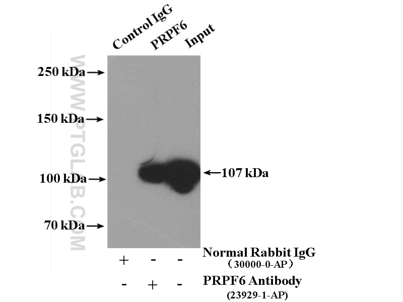 IP experiment of HeLa using 23929-1-AP