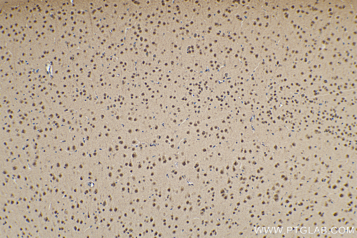 IHC staining of mouse brain using 11171-1-AP