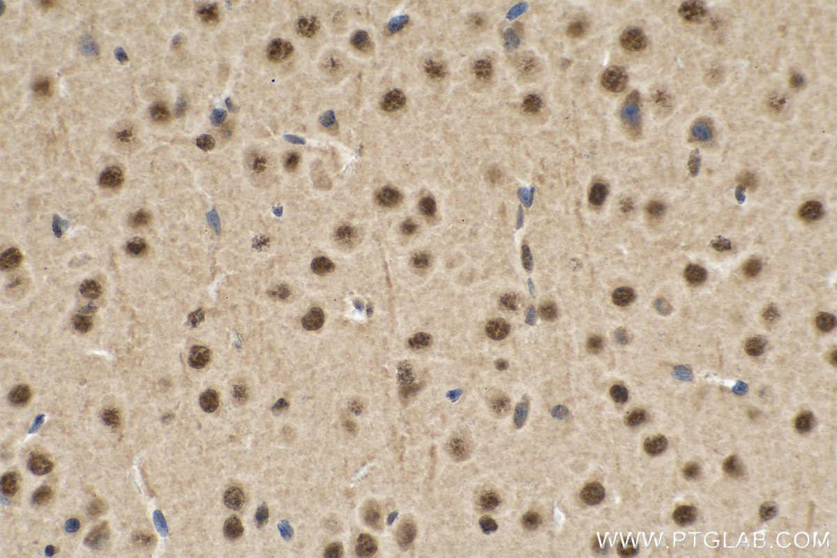 IHC staining of mouse brain using 11171-1-AP