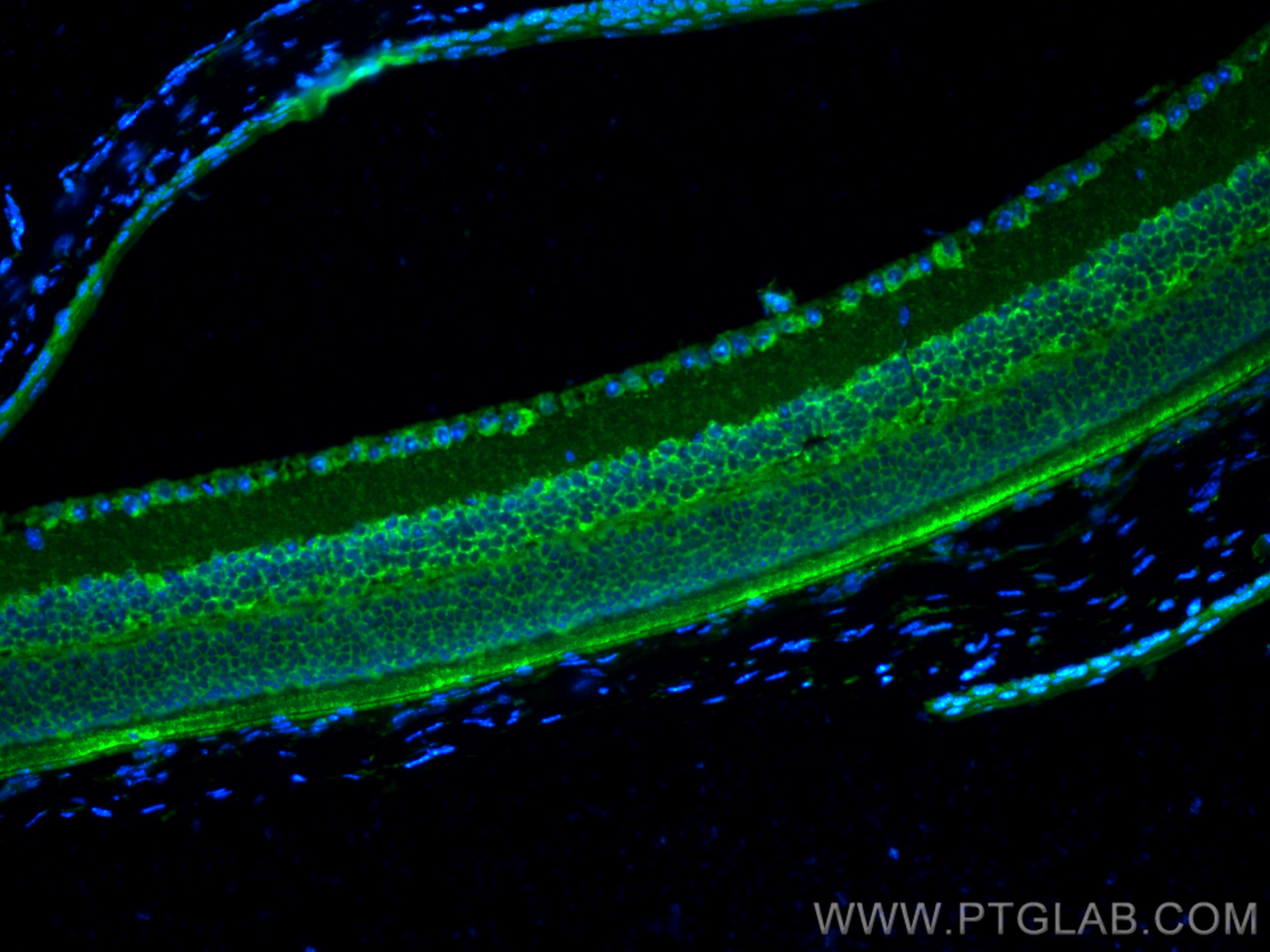 IF Staining of mouse eye using 18109-1-AP