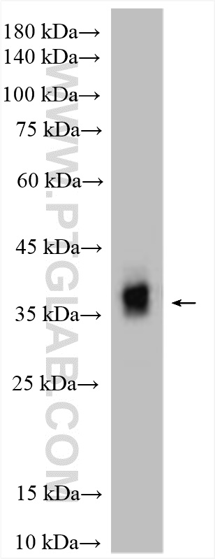 WB analysis of mouse eye using 18109-1-AP