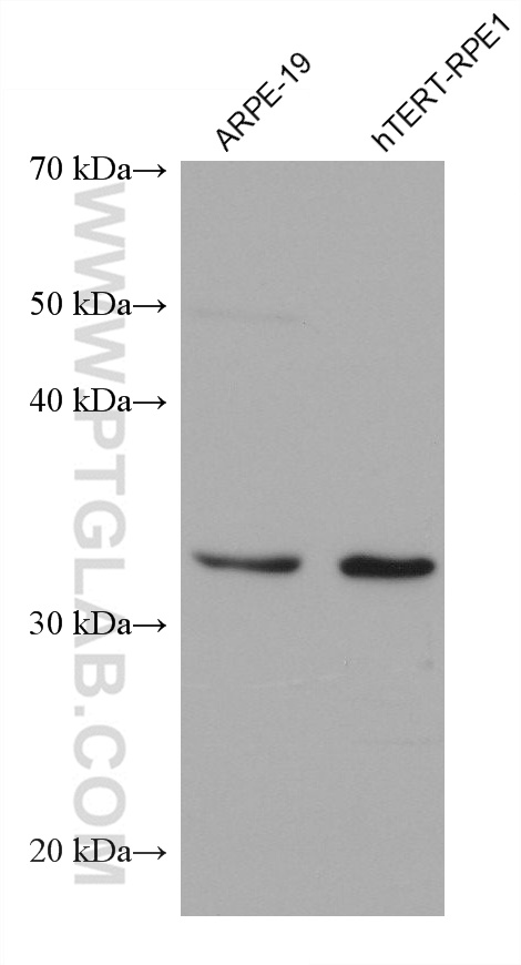 WB analysis using 68780-1-Ig