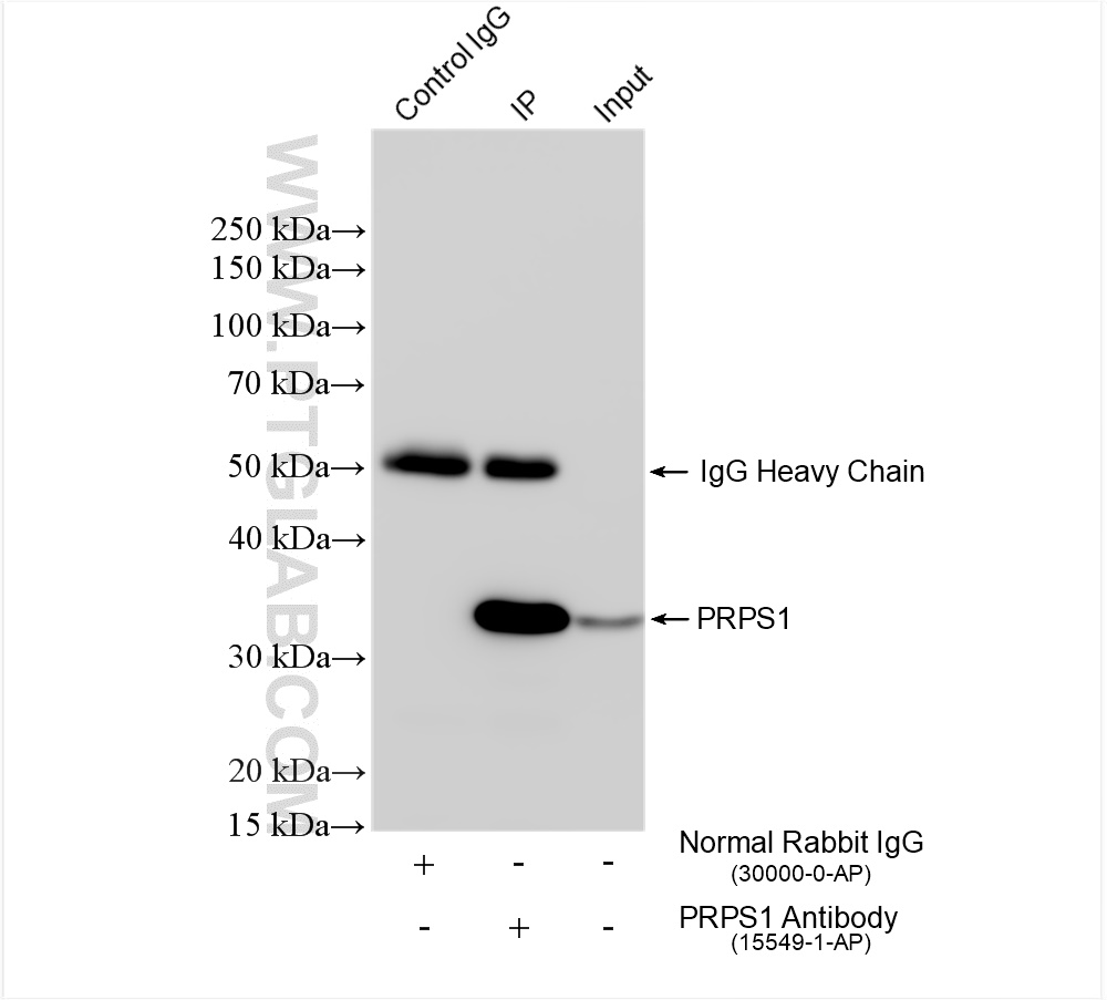 IP experiment of HeLa using 15549-1-AP