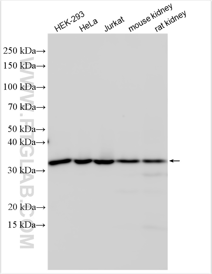 WB analysis using 15549-1-AP