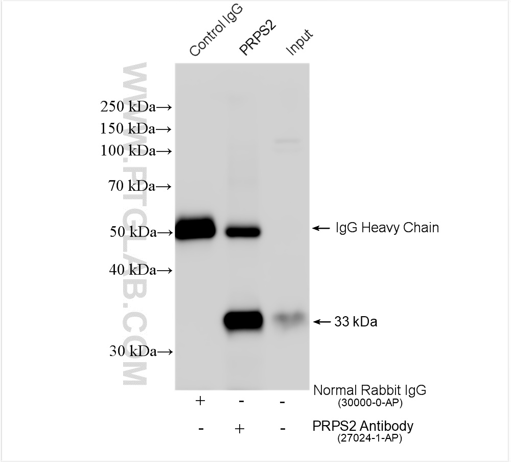 IP experiment of mouse spleen using 27024-1-AP