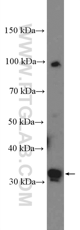 WB analysis of A375 using 27024-1-AP