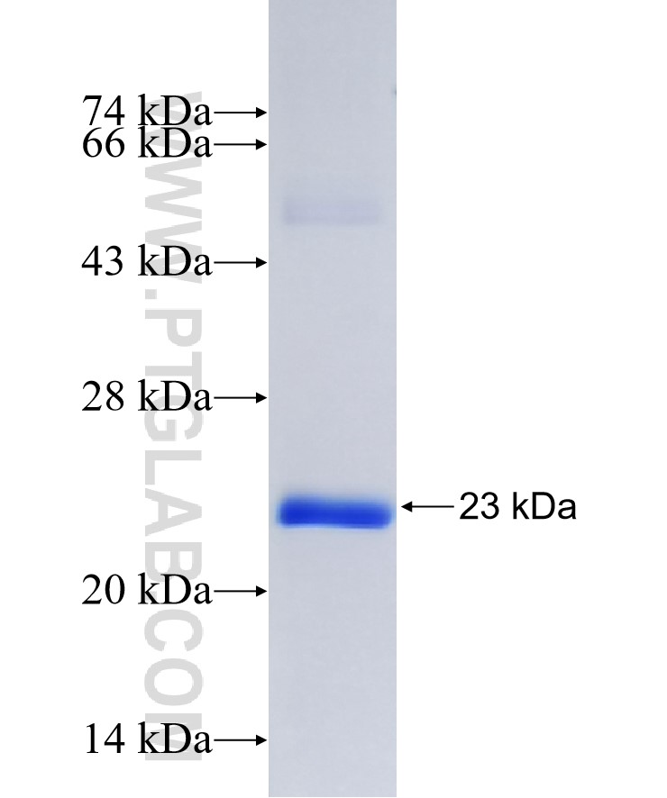 PRPS2 fusion protein Ag25704 SDS-PAGE