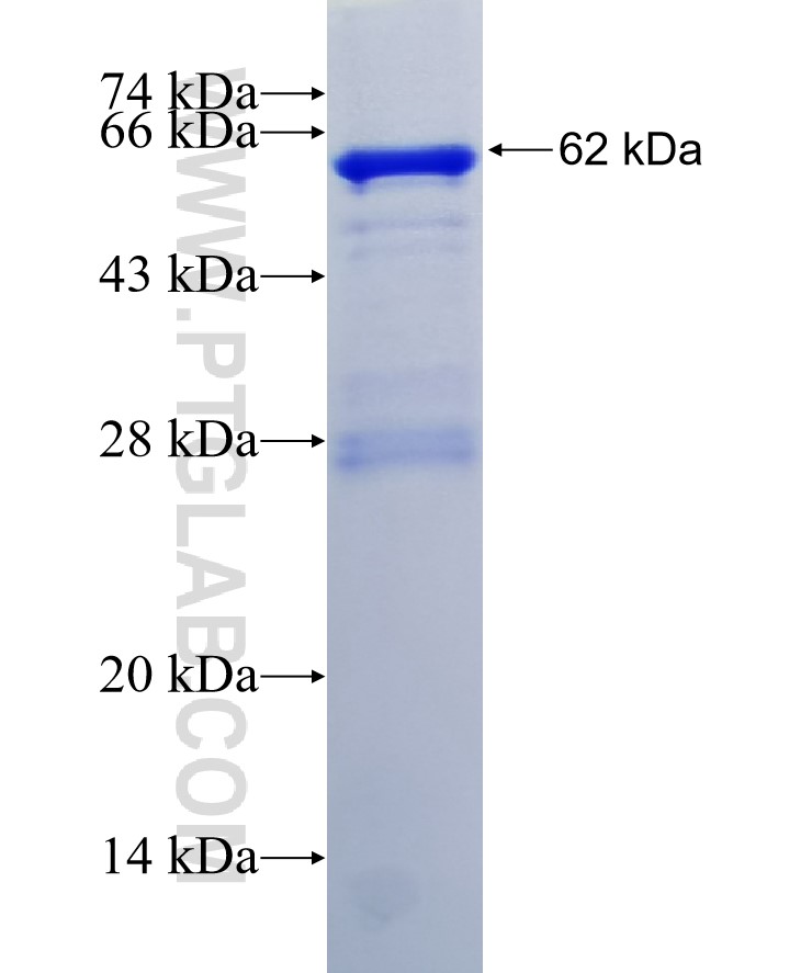 PRPSAP2 fusion protein Ag12132 SDS-PAGE