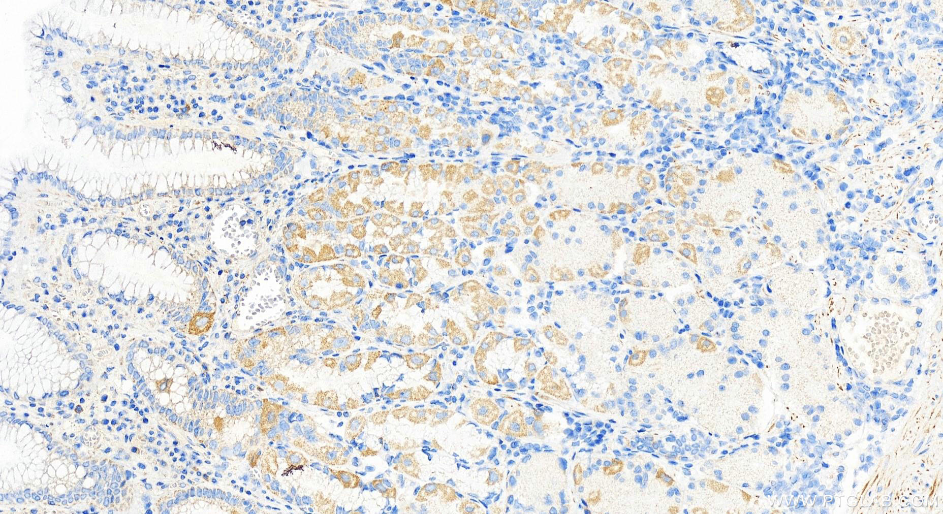 IHC staining of human stomach using 22819-1-AP