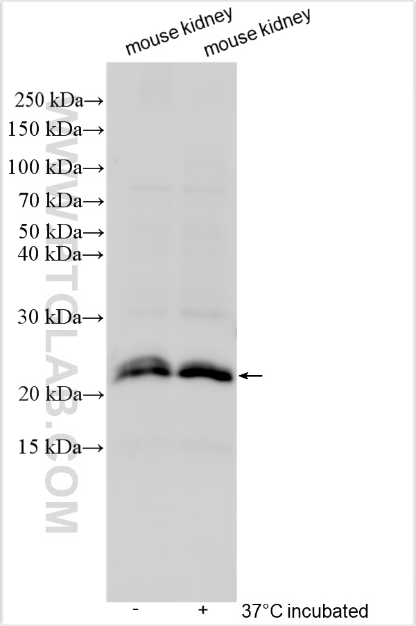 WB analysis using 11618-1-AP