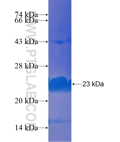 PRRX1 fusion protein Ag21013 SDS-PAGE