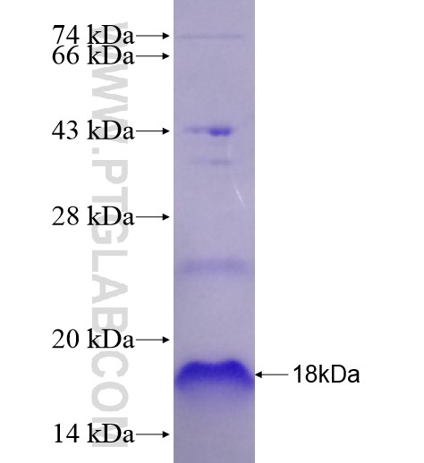 PRRX1 fusion protein Ag28317 SDS-PAGE