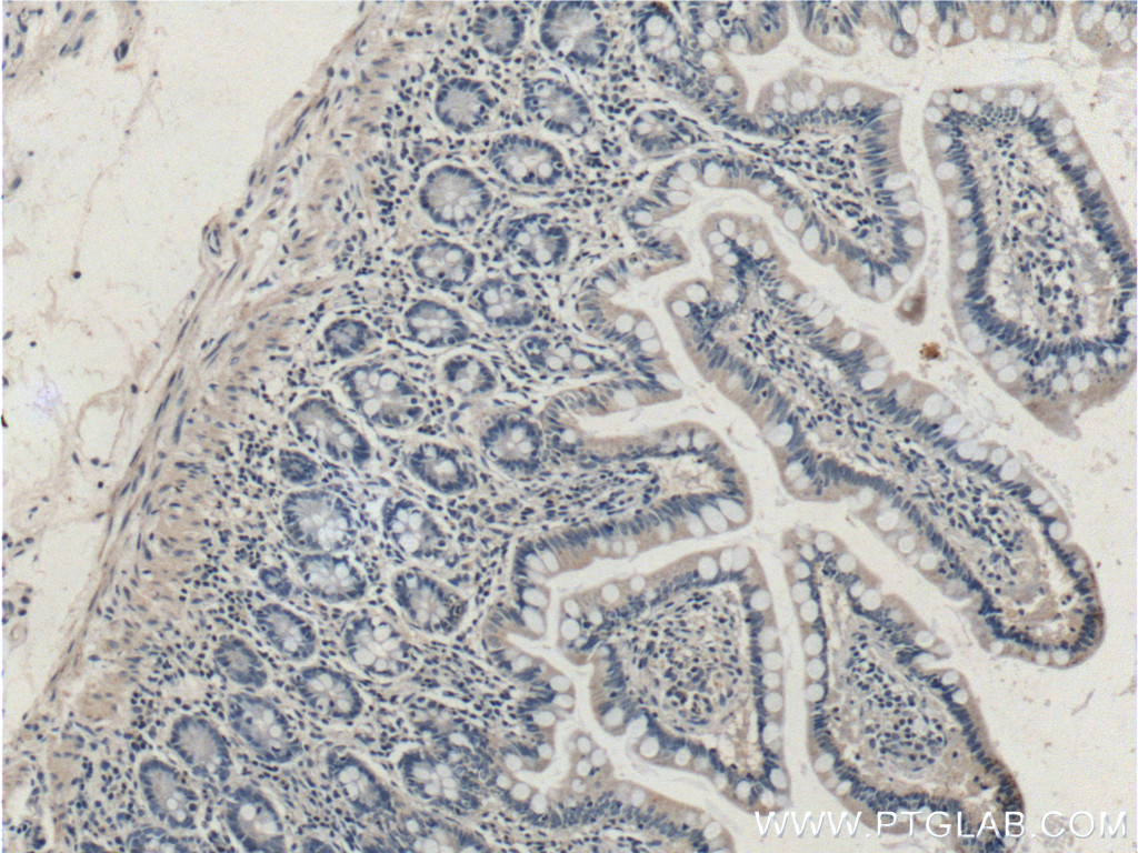 IHC staining of human small intestine using 15005-1-AP