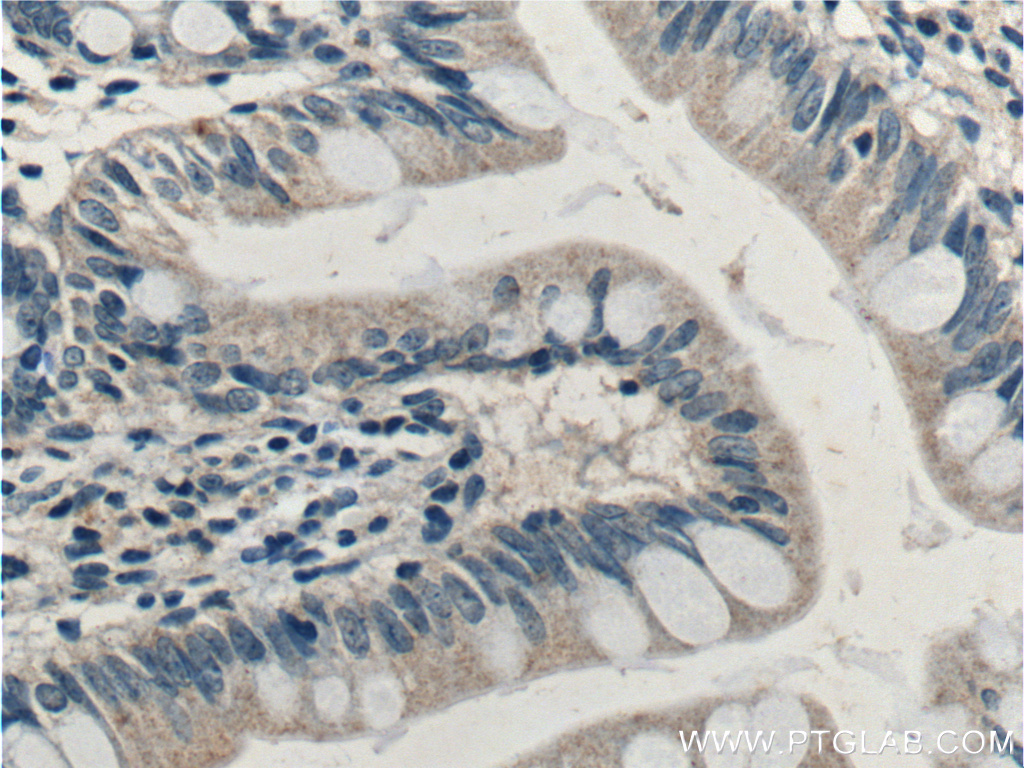 IHC staining of human small intestine using 15005-1-AP