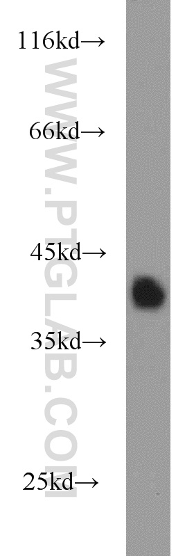 WB analysis of human colon using 15527-1-AP