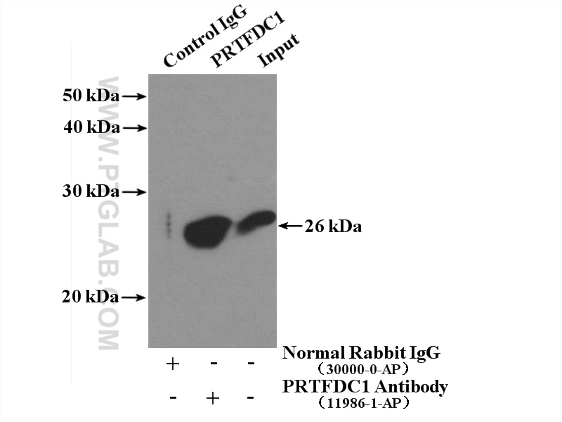 IP experiment of mouse brain using 11986-1-AP