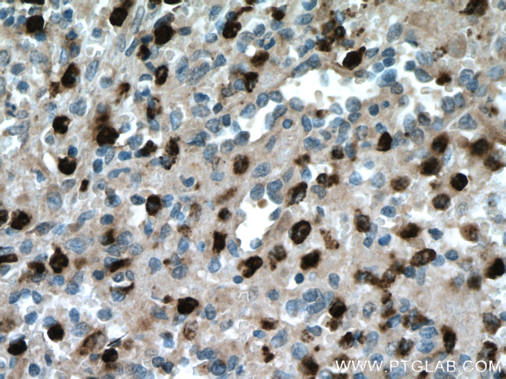 IHC staining of human spleen using 27153-1-AP