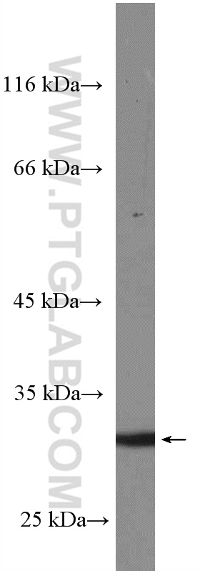 WB analysis of human spleen using 27153-1-AP