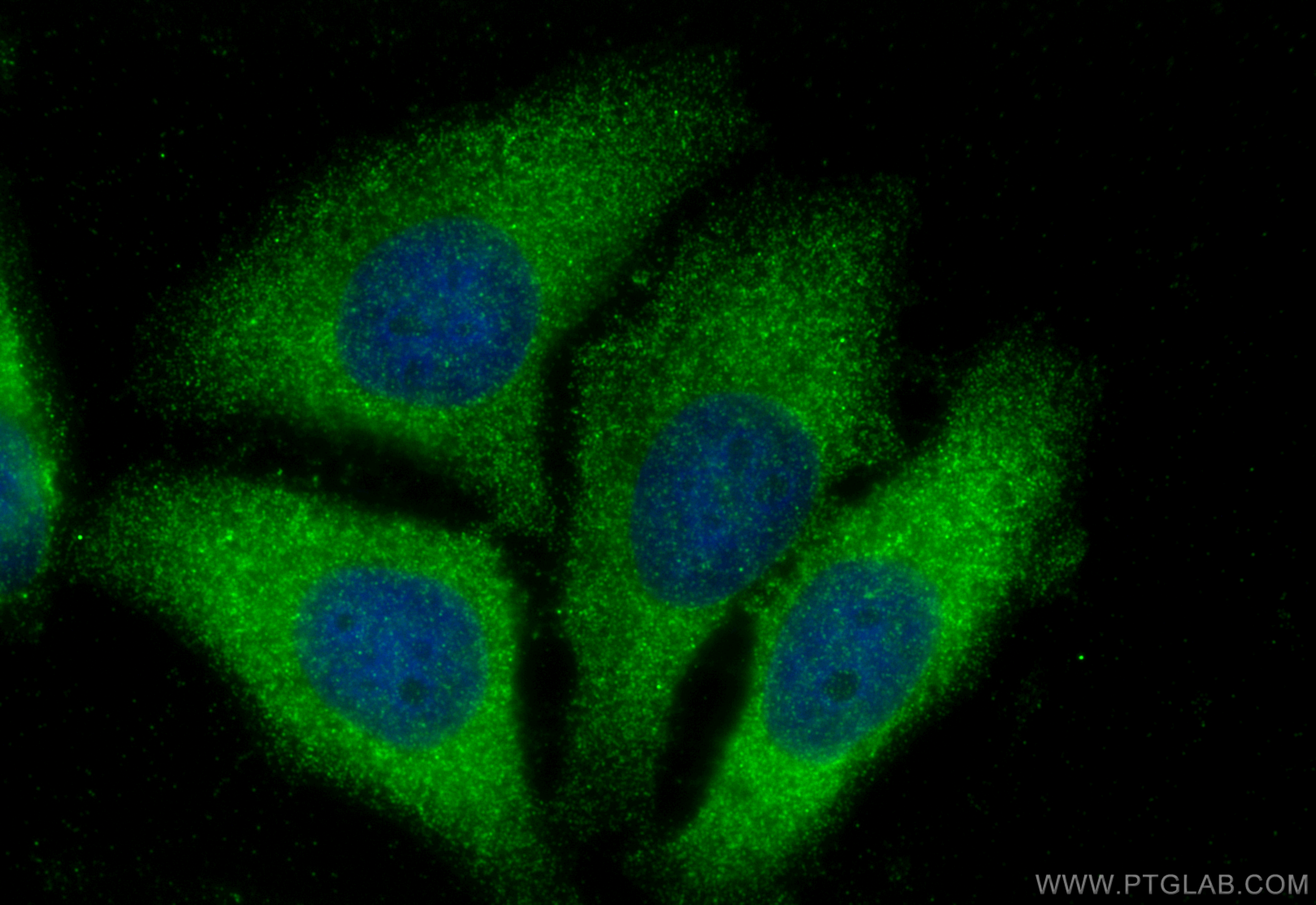 IF Staining of HepG2 using 18537-1-AP