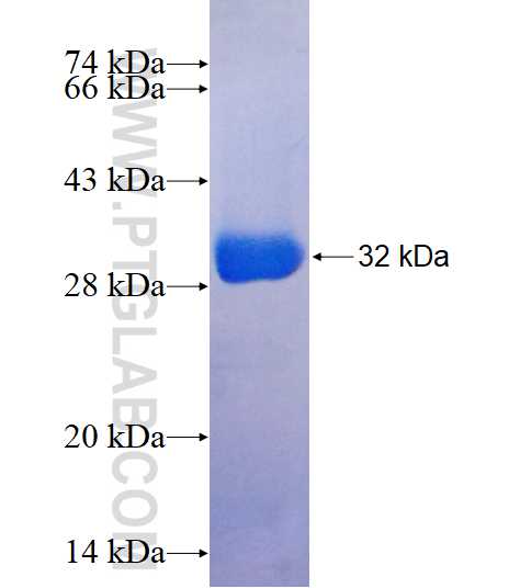 PRUNE2 fusion protein Ag17913 SDS-PAGE