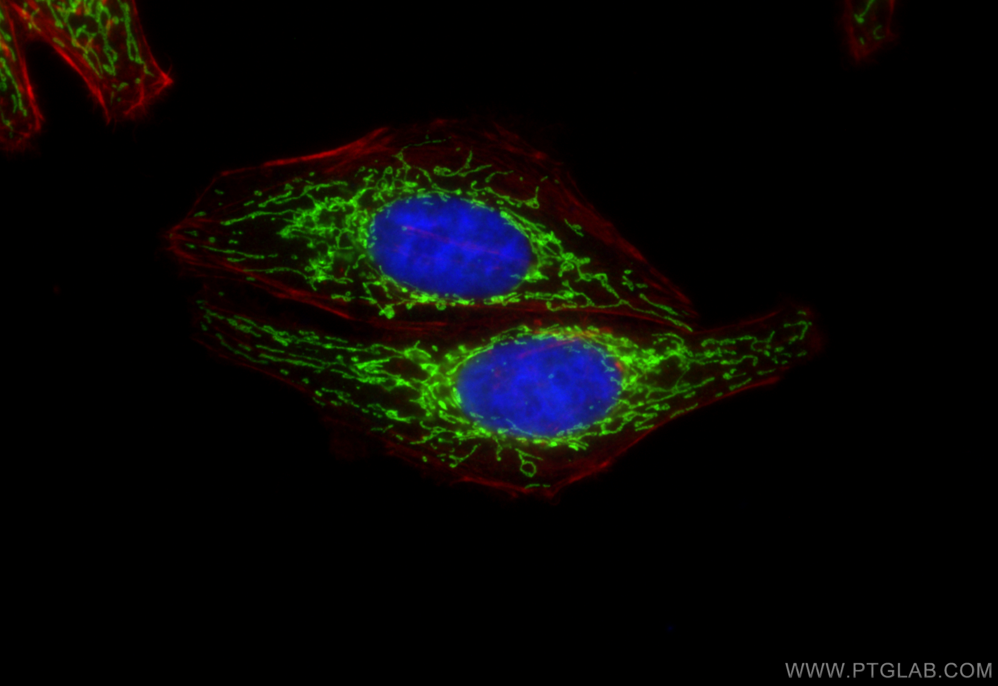 IF Staining of HepG2 using 10664-1-AP