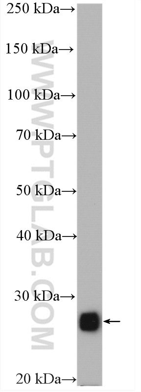 WB analysis of HeLa using 10664-1-AP