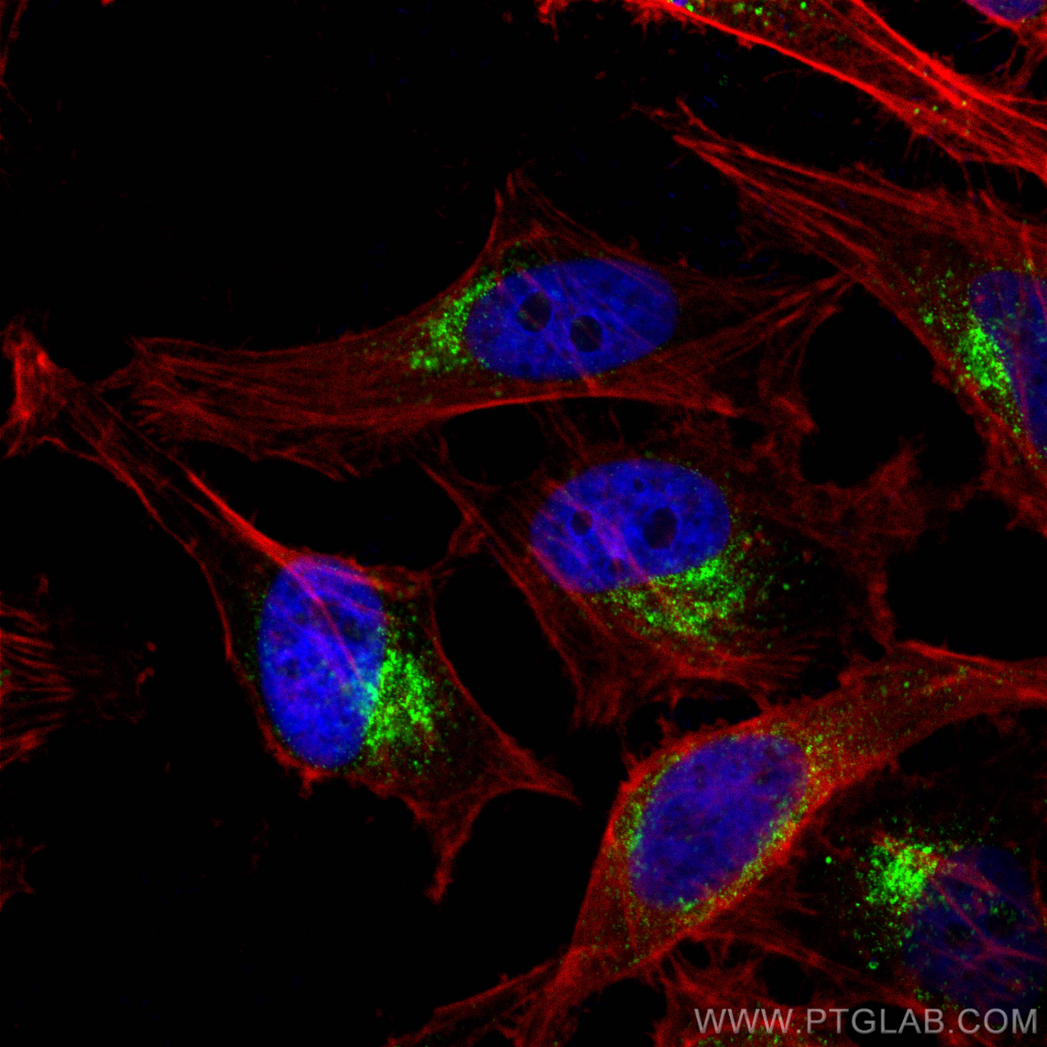 IF Staining of HeLa using 10801-1-AP