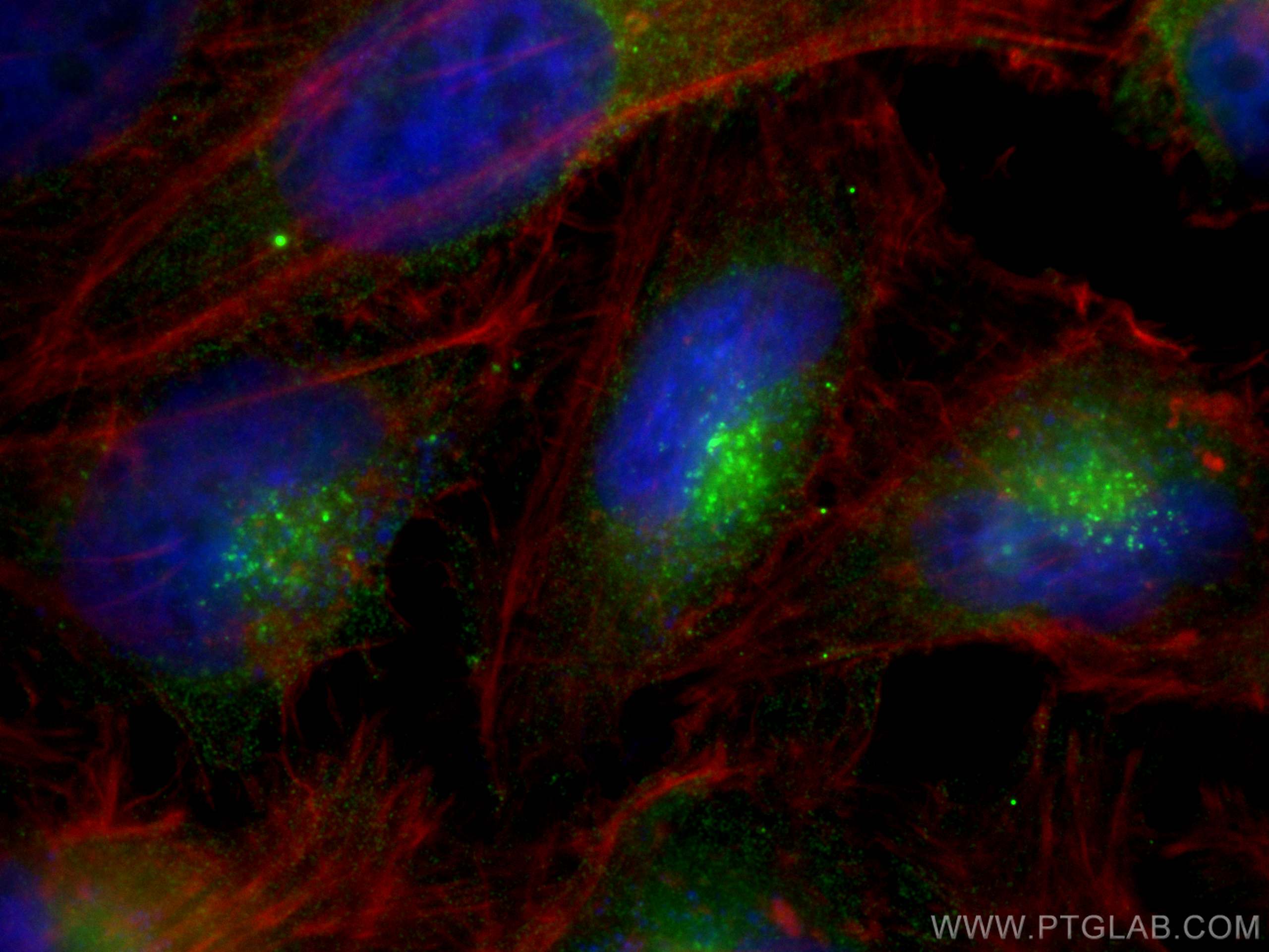 IF Staining of HeLa using 66473-1-Ig (same clone as 66473-1-PBS)