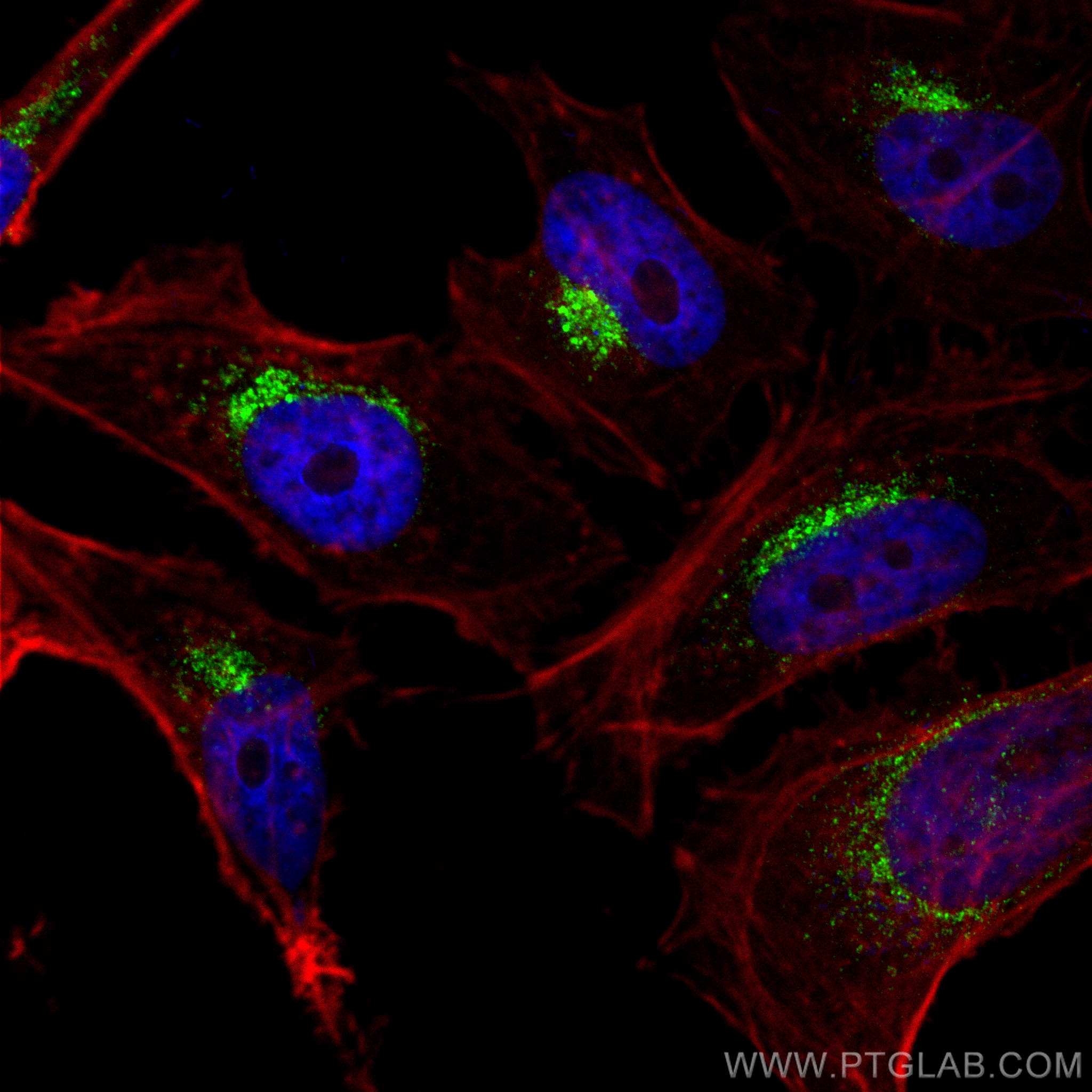 IF Staining of HeLa using CL488-10801
