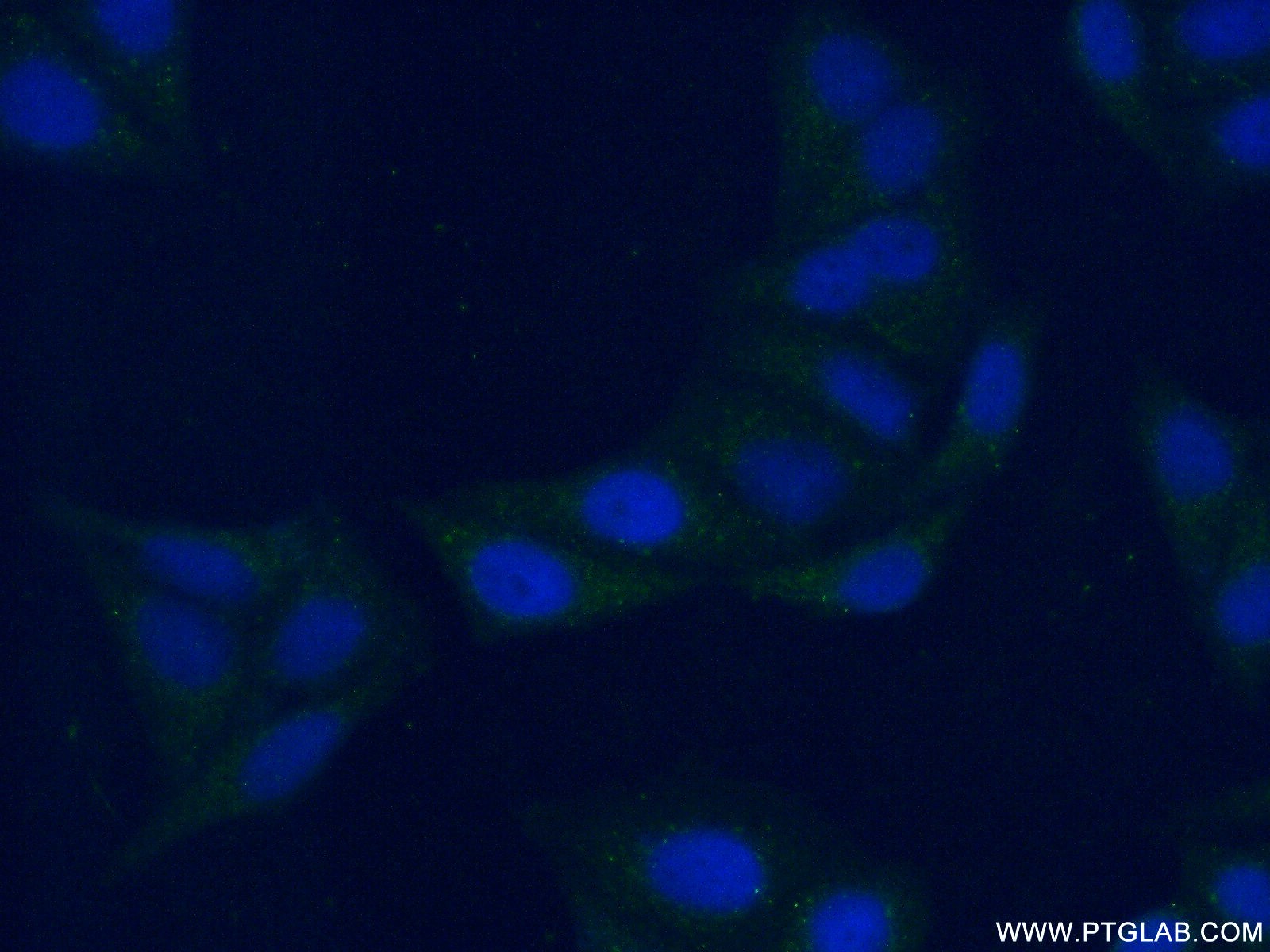 IF Staining of HepG2 using 55128-1-AP