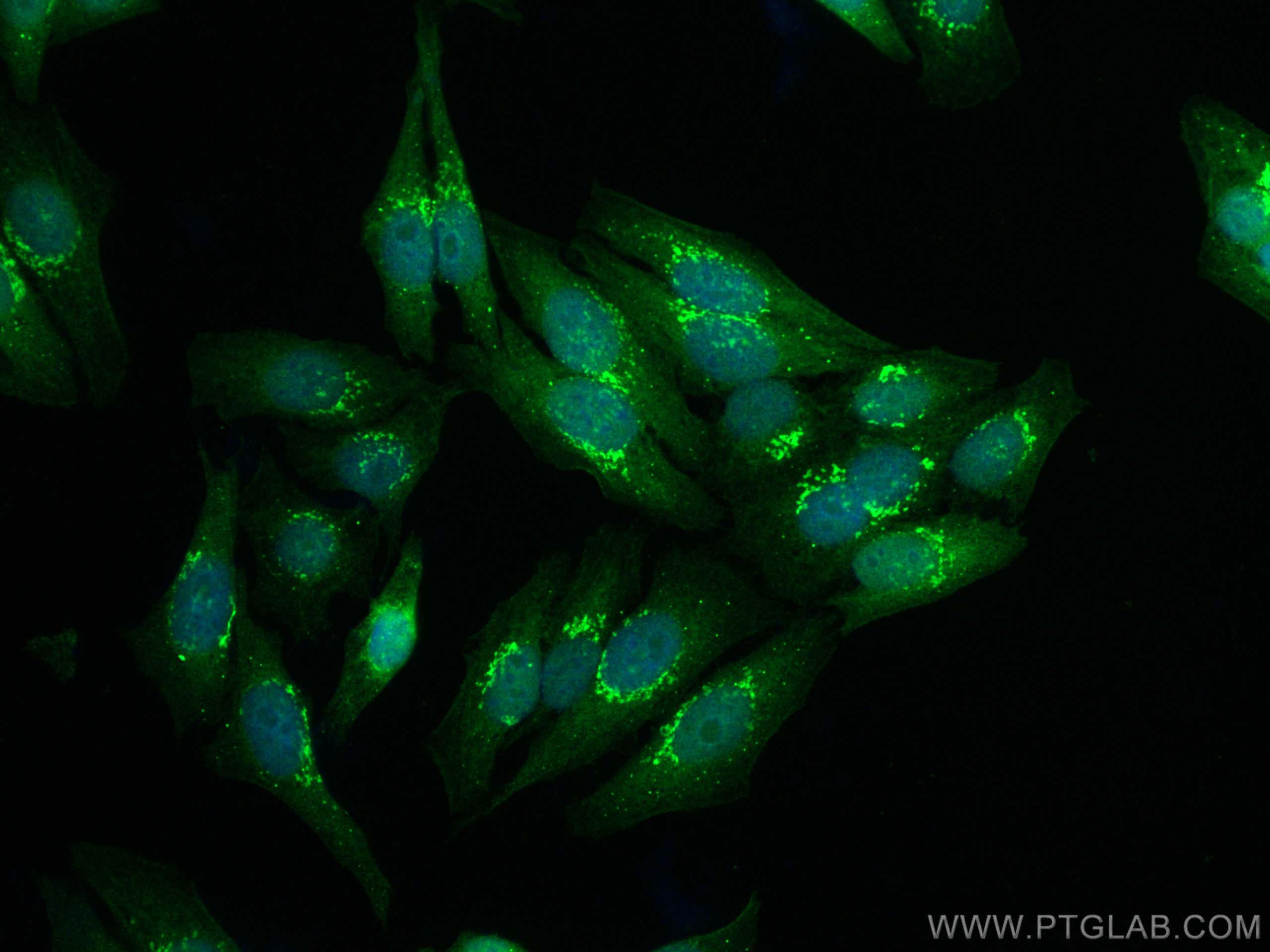 IF Staining of HepG2 using 20180-1-AP