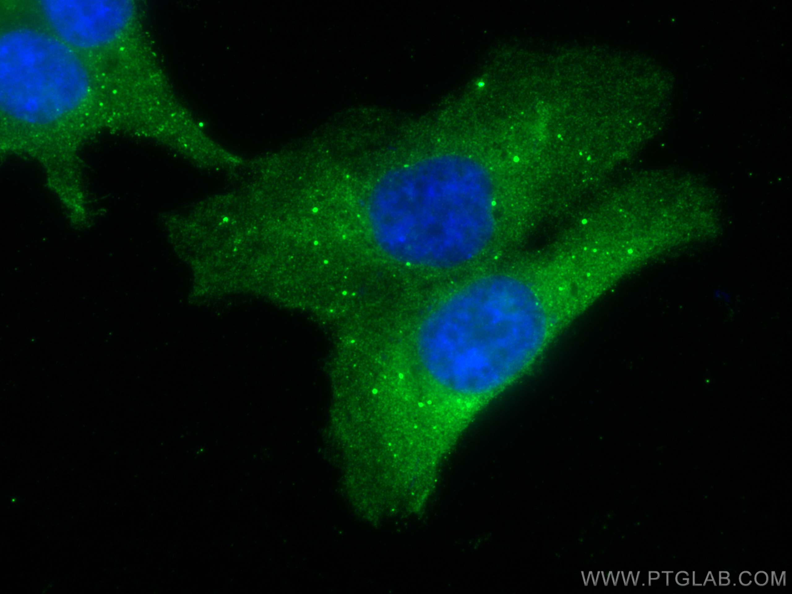 IF Staining of HCT 116 using 67619-1-Ig (same clone as 67619-1-PBS)