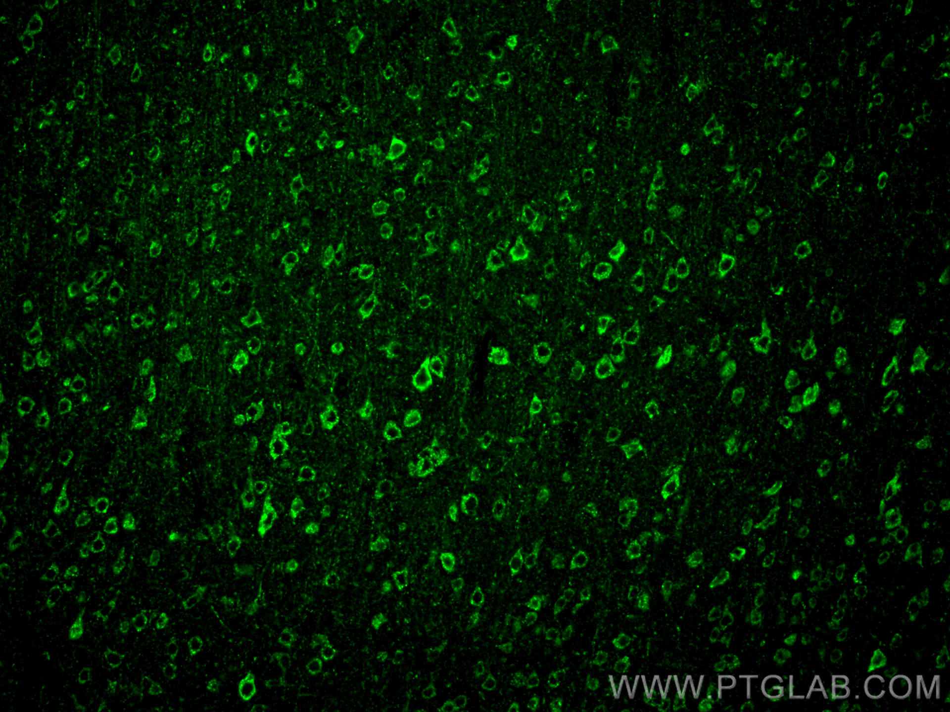 IF Staining of mouse brain using 20665-1-AP