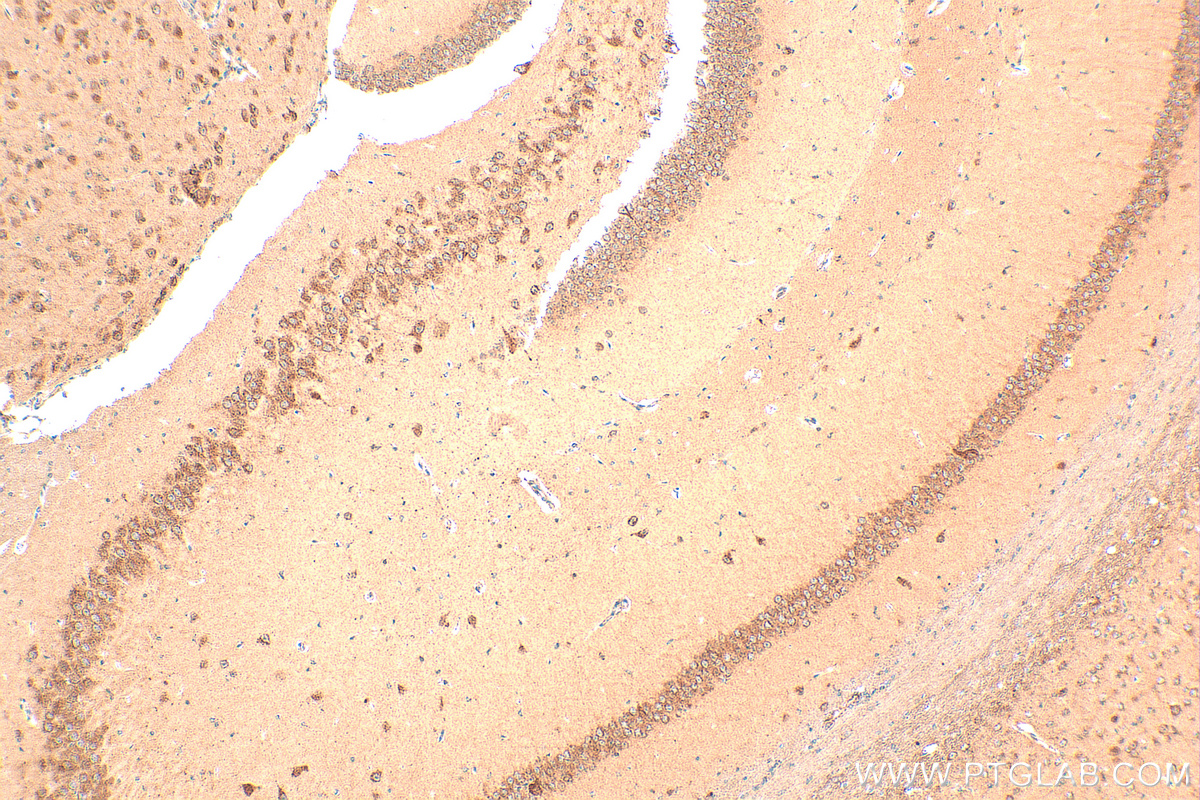 IHC staining of mouse brain using 20665-1-AP