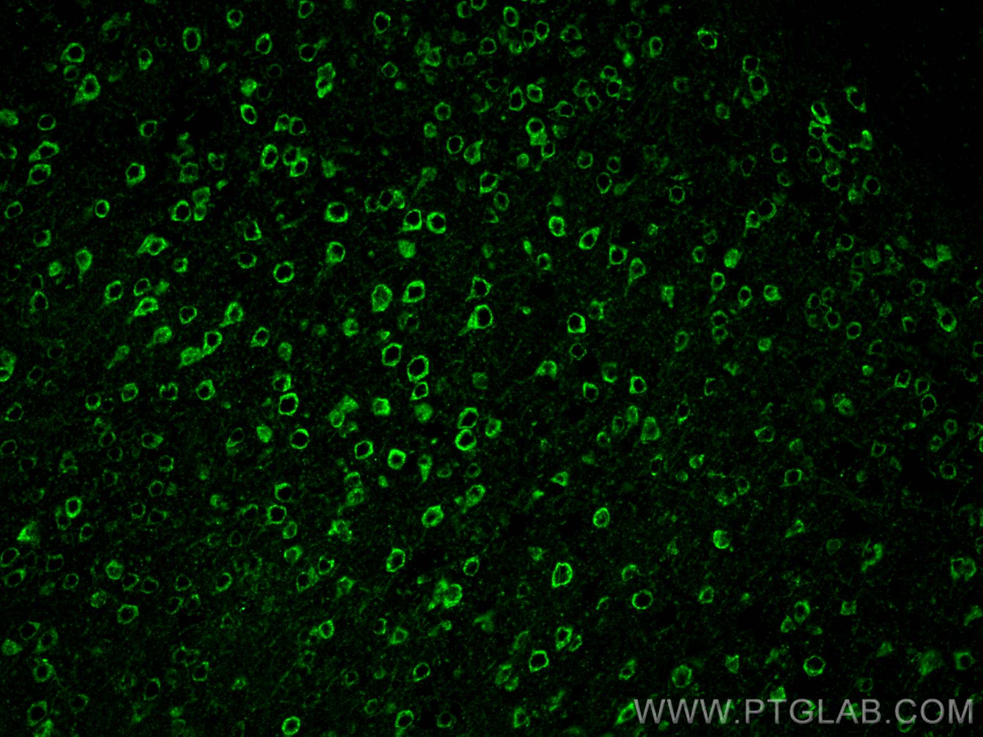 IF Staining of mouse brain using 81106-1-RR (same clone as 81106-1-PBS)