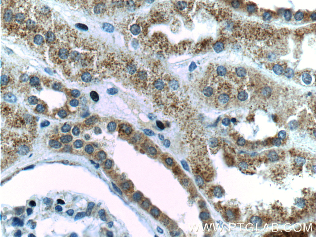 IHC staining of human kidney using 16168-1-AP