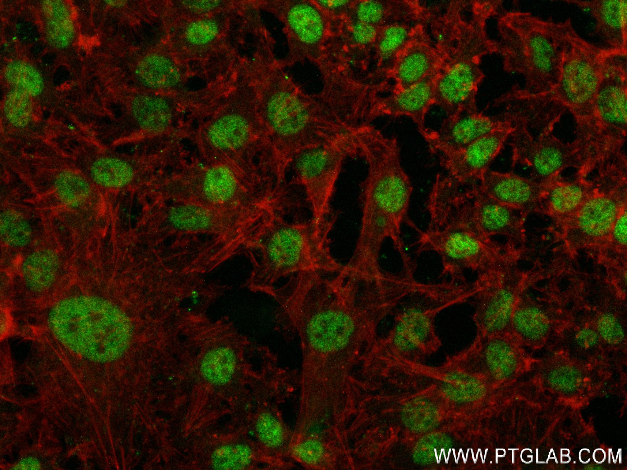 IF Staining of HeLa using 84486-2-RR (same clone as 84486-2-PBS)