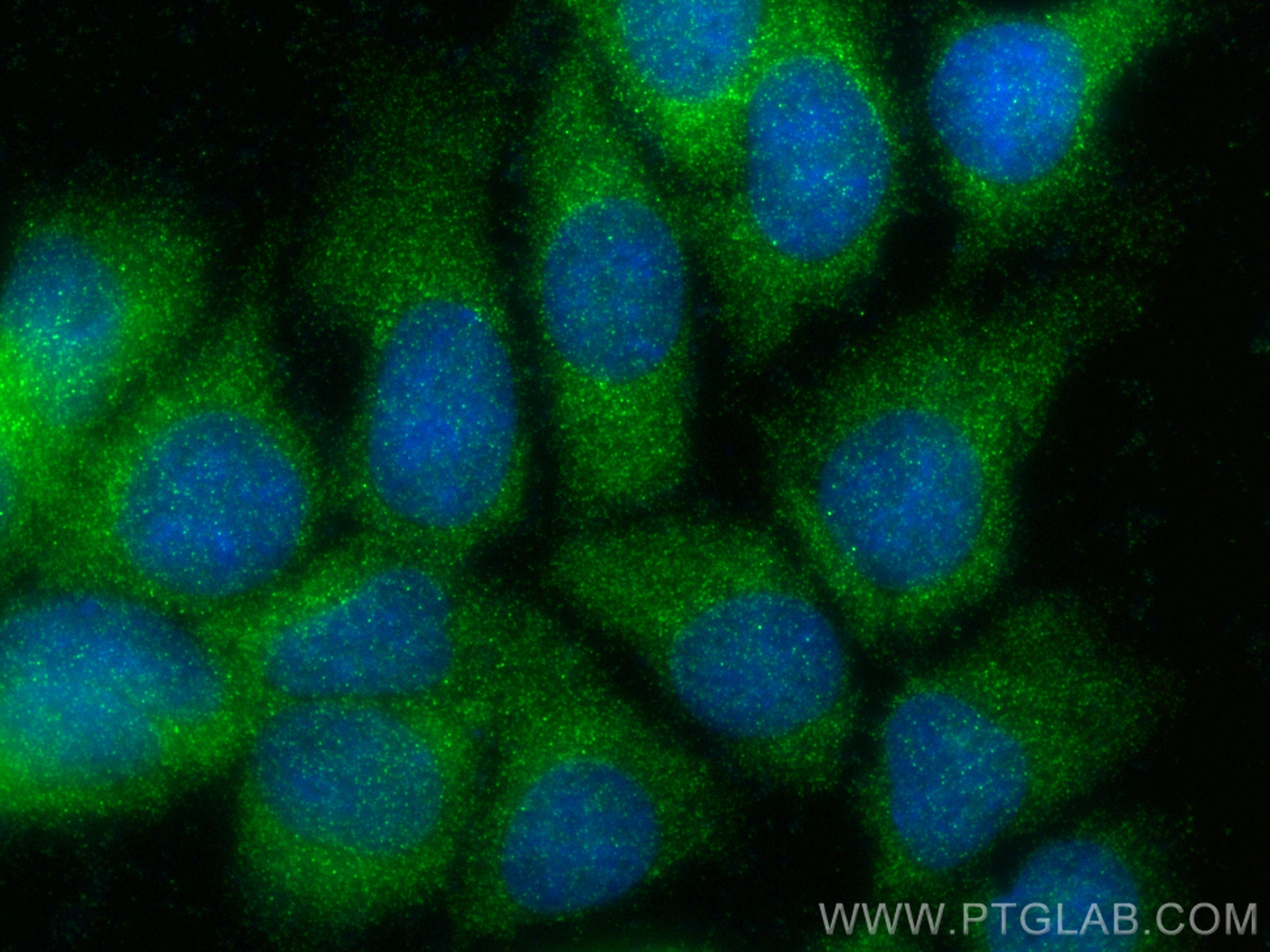 IF Staining of MCF-7 using 11809-1-AP