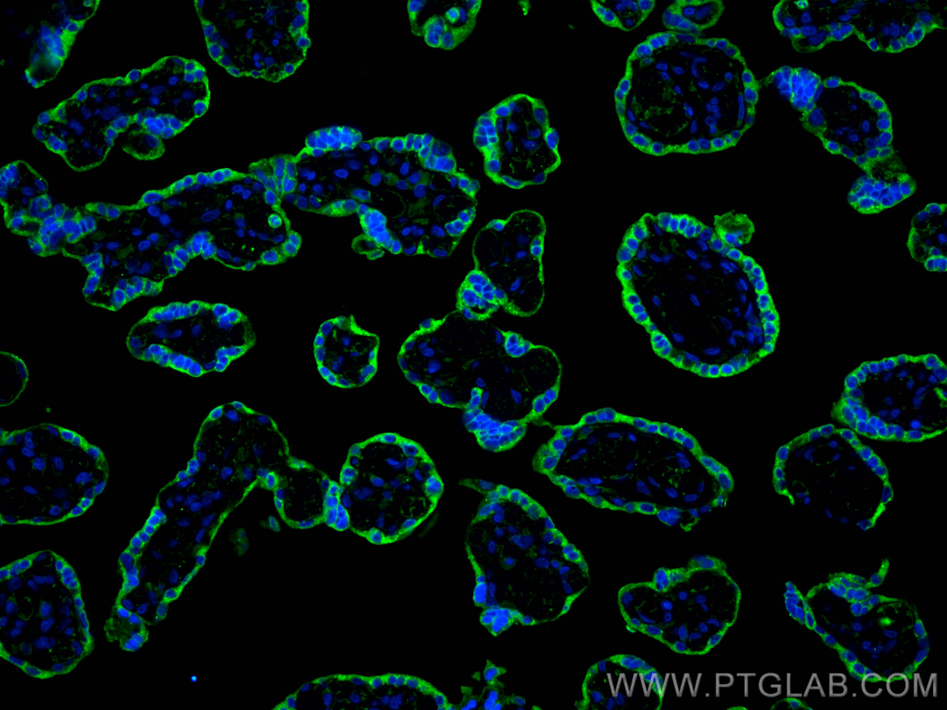 IF Staining of human placenta using 67269-1-Ig (same clone as 67269-1-PBS)