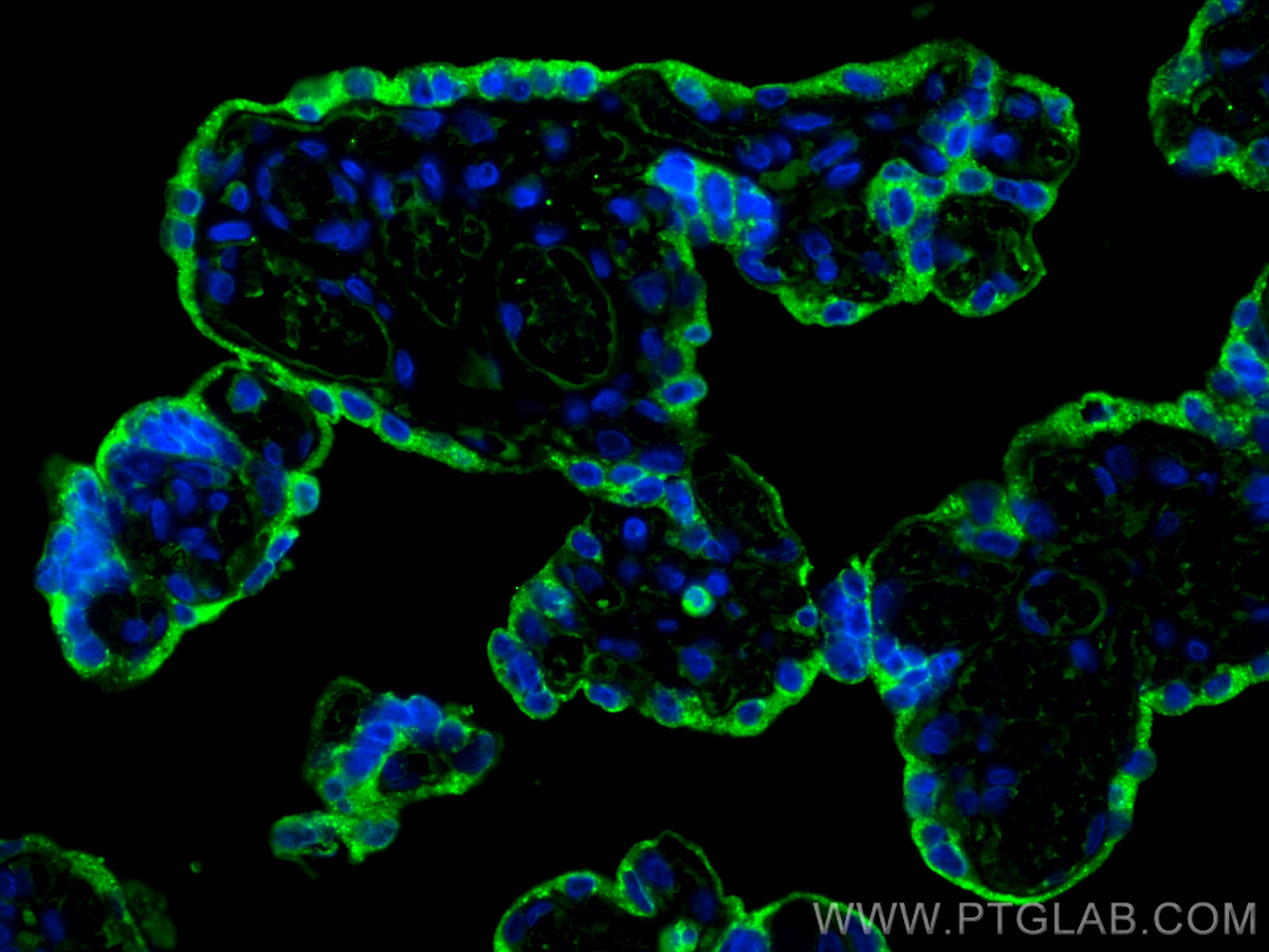 IF Staining of human placenta using 67269-1-Ig (same clone as 67269-1-PBS)