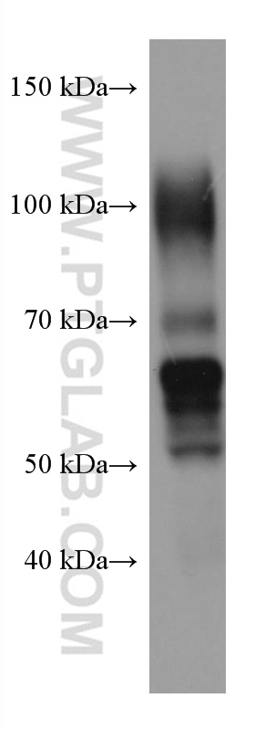 WB analysis of human placenta using 67269-1-Ig (same clone as 67269-1-PBS)