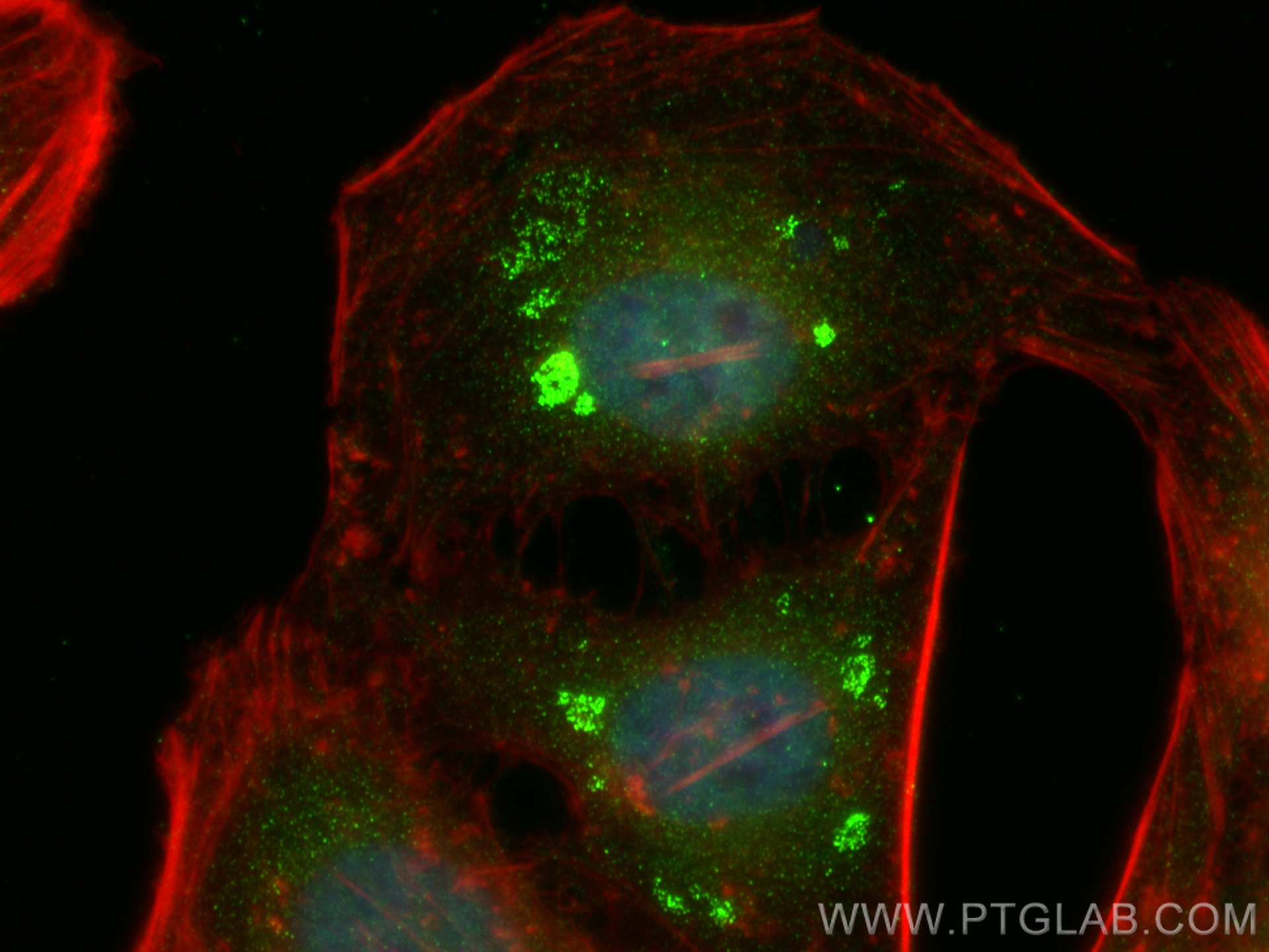 IF Staining of HeLa using 16352-1-AP