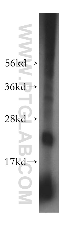 WB analysis of mouse uterus using 16352-1-AP