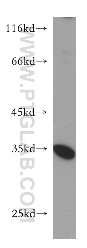 WB analysis of HepG2 using 18813-1-AP