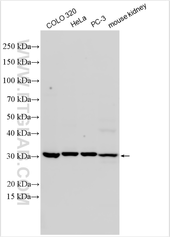 WB analysis using 11175-1-AP