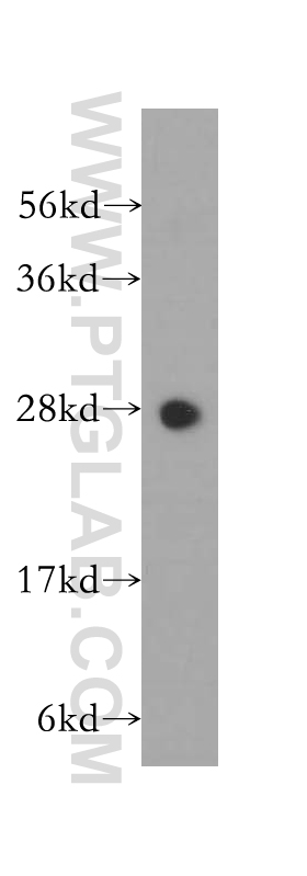 WB analysis of human lung using 11887-1-AP