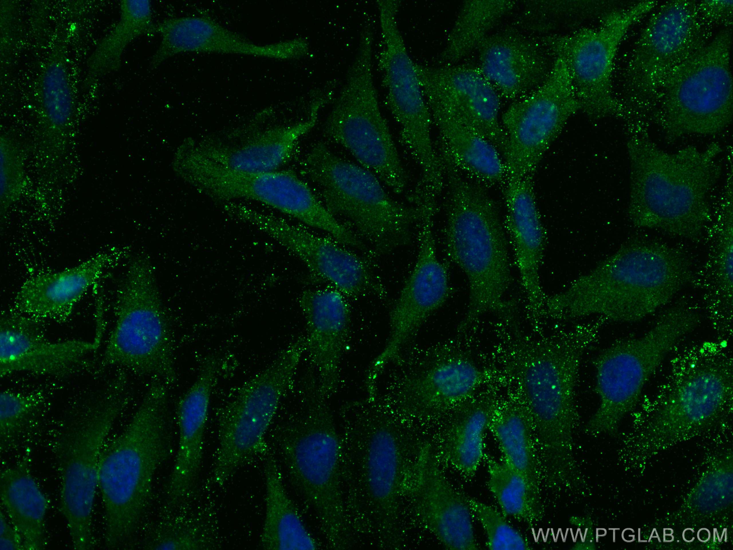 IF Staining of HeLa using 67695-1-Ig (same clone as 67695-1-PBS)