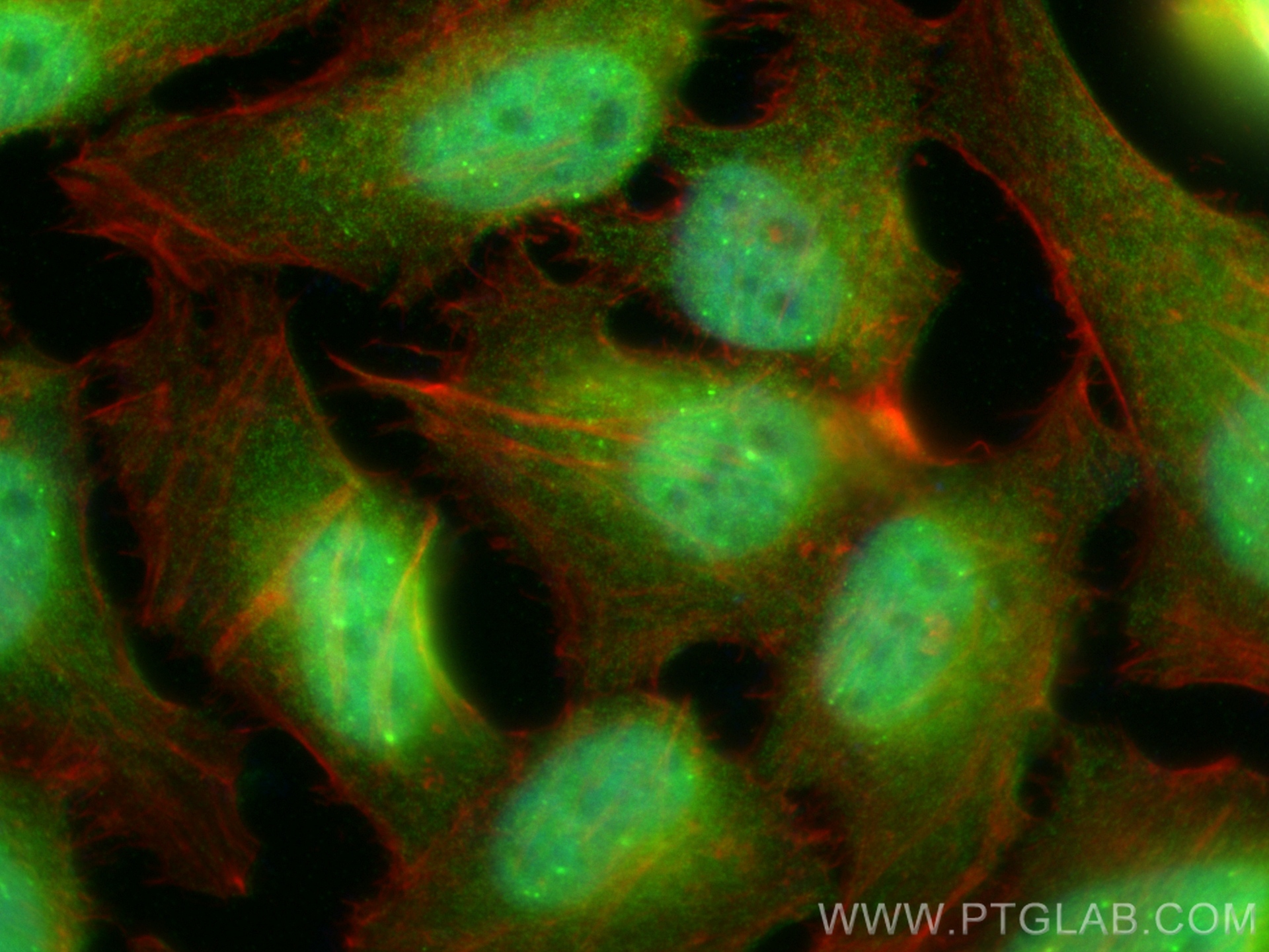 IF Staining of HeLa using 15219-1-AP