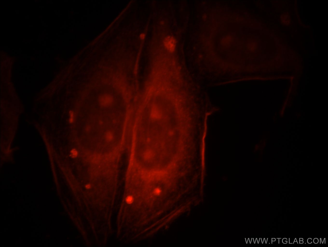 IF Staining of HepG2 using 14022-1-AP